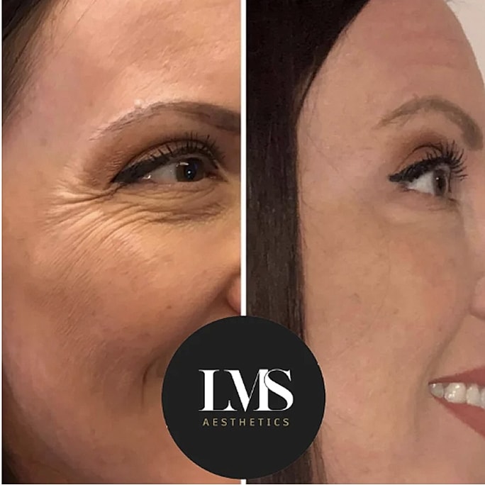 Before and after aesthetic treatment comparison.